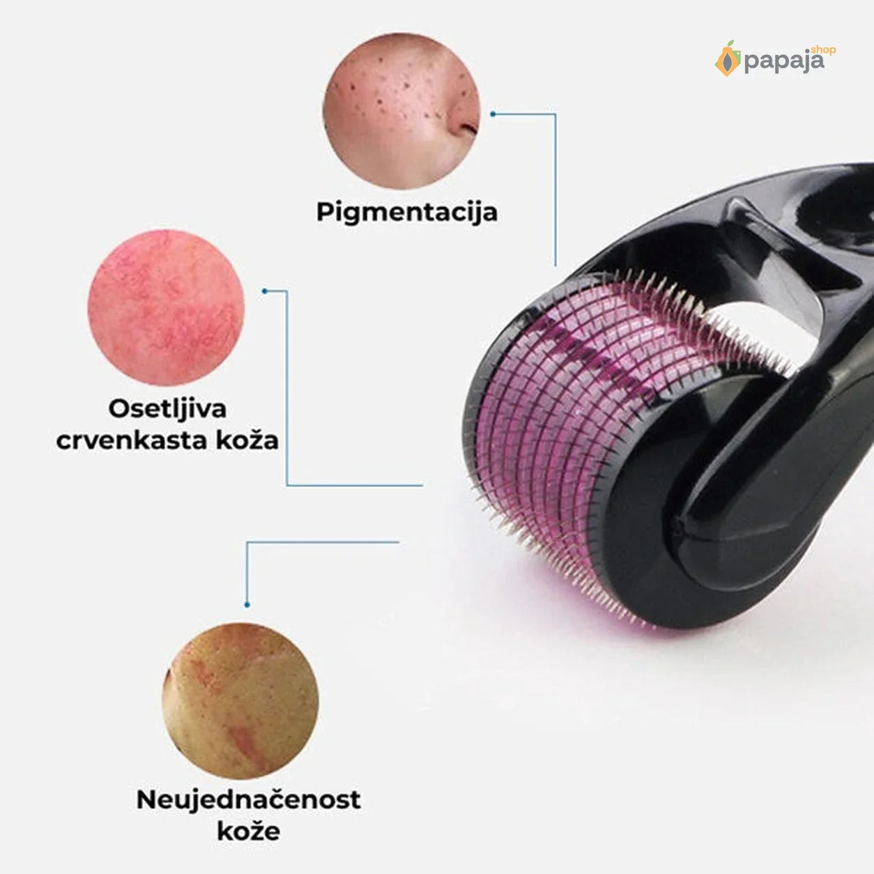 Derma Roller kućna profesionalna anti-age nega